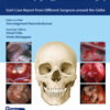 100 Complications of Otorhinolaryngology