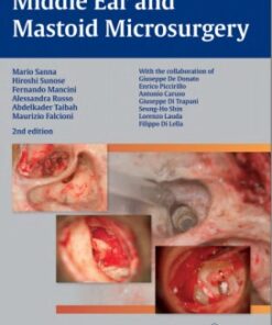 Middle Ear and Mastoid Microsurgery 2nd edition