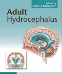 Adult Hydrocephalus 1st Edition