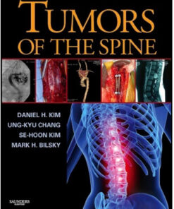 Tumors of the Spine