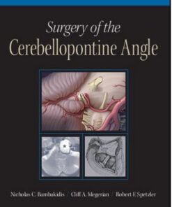 Surgery of the Cerebellopontine Angle 1st Edition