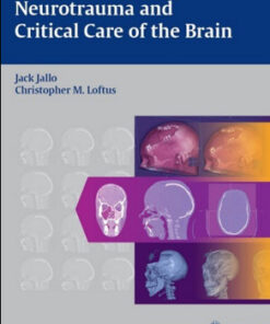 Neurotrauma and Critical Care of the Brain