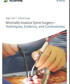 Minimally Invasive Spine Surgery: Techniques, Evidence, and Controversies