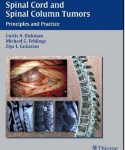 Spinal Cord and Spinal Column Tumors: Principles and Practice