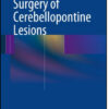 Surgery of Cerebellopontine Lesions