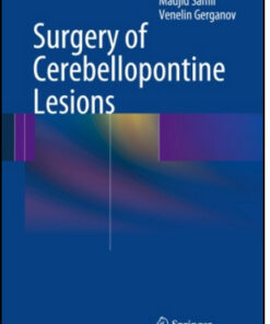 Surgery of Cerebellopontine Lesions