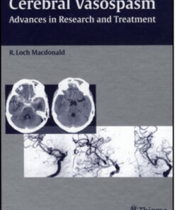 Cerebral Vasospasm: Advances in Research and Treatment