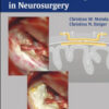 Hemostasis and Fleece-Bound Sealing in Neurosurgery