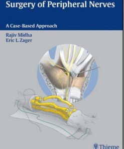 Surgery of Peripheral Nerves: A Case-Based Approach