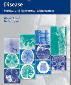 Neurosurgical Infectious Disease: Surgical and Nonsurgical Management