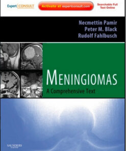 Meningiomas: A Comprehensive Text Expert Consult – Online and Print