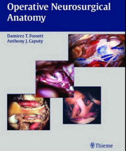 Operative Neurosurgical Anatomy