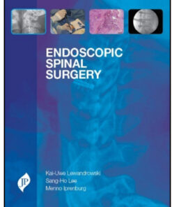 Endoscopic Spinal Surgery