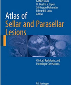 Atlas of Sellar and Parasellar Lesions: Clinical, Radiologic, and Pathologic Correlations 1st ed. 2016 Edition