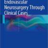 Endovascular Neurosurgery Through Clinical Cases 2015th Edition