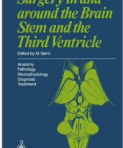 Surgery in and around the Brain Stem and the Third Ventricle: Anatomy · Pathology · Neurophysiology Diagnosis · Treatment