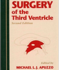 Surgery of the Third Ventricle Second Edition