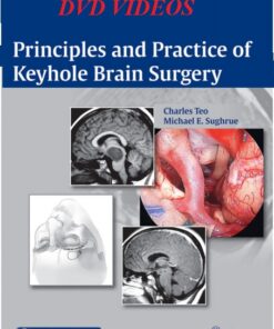 Principles and Practice of Keyhole Brain Surgery – Original PDF + Videos