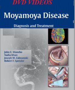 Moyamoya Disease: Diagnosis and Treatment – Original PDF + Videos