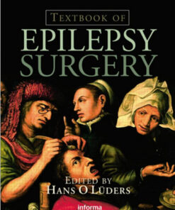 Textbook of Epilepsy Surgery 1st Edition