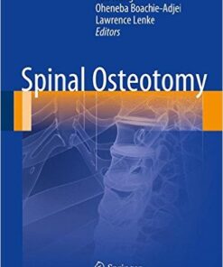 Spinal Osteotomy 2015th Edition