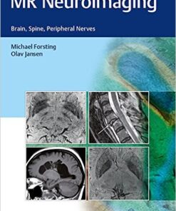 MR Neuroimaging: Brain, Spine, and Peripheral Nerves 1st Edition Original PDF​