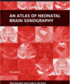 An Atlas of Neonatal Brain Sonography-Original PDF