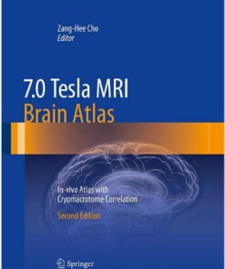 7.0 Tesla MRI Brain Atlas: In-vivo Atlas with Cryomacrotome Correlation 2nd ed. 2015 Edition