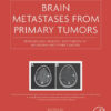 Brain Metastases from Primary Tumors, Volume 3: Epidemiology, Biology, and Therapy of Melanoma and Other Cancers 1st Edition