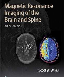 Magnetic Resonance Imaging of the Brain and Spine Fifth Edition PDF