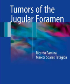 Tumors of the Jugular Foramen 1st ed. 2017 Edition PDF