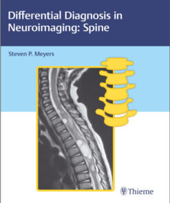 Differential Diagnosis in Neuroimaging: Spine-Original PDF