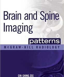 Brain and Spine Imaging Patterns (McGraw-Hill Radiology) 1st Edition