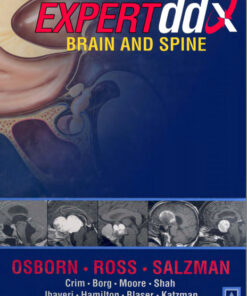 Expertddx: Brain and Spine 1st Edition PDF ORIGINAL