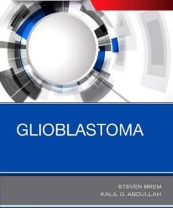 Glioblastoma