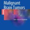 Malignant Brain Tumors : State-of-the-Art Treatment