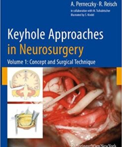 Keyhole Approaches in Neurosurgery: Volume 1: Concept and Surgical Technique 2008th Edition PDF