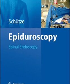 Epiduroscopy: Spinal Endoscopy 1st Edition PDF