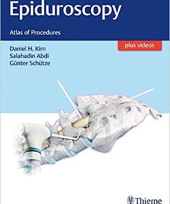 Epiduroscopy: Atlas of Procedures 1st Edition PDF