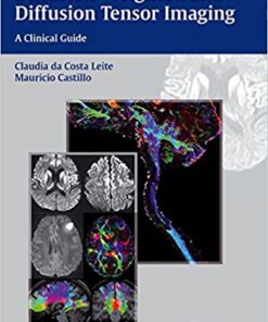 Diffusion Weighted and Diffusion Tensor Imaging: A Clinical Guide 1st Edition PDF