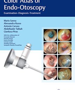 Color Atlas of Endo-Otoscopy: Examination-Diagnosis-Treatment PDF