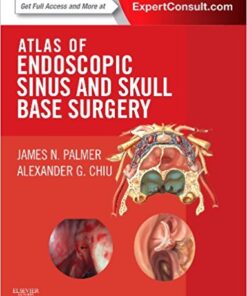 Atlas of Endoscopic Sinus and Skull Base Surgery: Expert Consult - Online and Print, 1e PDF