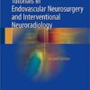 Tutorials in Endovascular Neurosurgery and Interventional Neuroradiology 2nd ed. 2017 Edition PDF