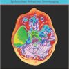 Arachnoid Cysts: Epidemiology, Biology, and Neuroimaging 1st Edition PDF