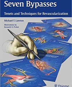 Seven Bypasses: Tenets and Techniques for Revascularization 1st Edition PDF