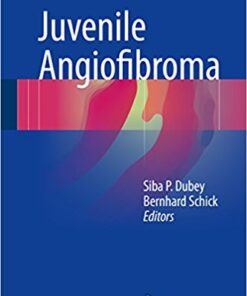 Juvenile Angiofibroma 1st ed. 2017 Edition PDF