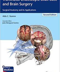 Transnasal Endoscopic Skull Base and Brain Surgery: Surgical Anatomy and its Applications 2nd Edition PDF & VIDEO