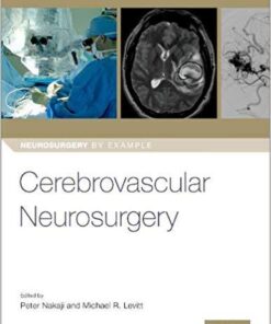 Cerebrovascular Neurosurgery (Neurosurgery by Example) PDF