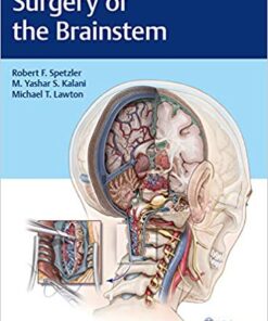 Surgery of the Brainstem 1st Edition PDF