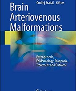 Brain Arteriovenous Malformations: Pathogenesis, Epidemiology, Diagnosis, Treatment and Outcome 1st ed. 2017 Edition PDF